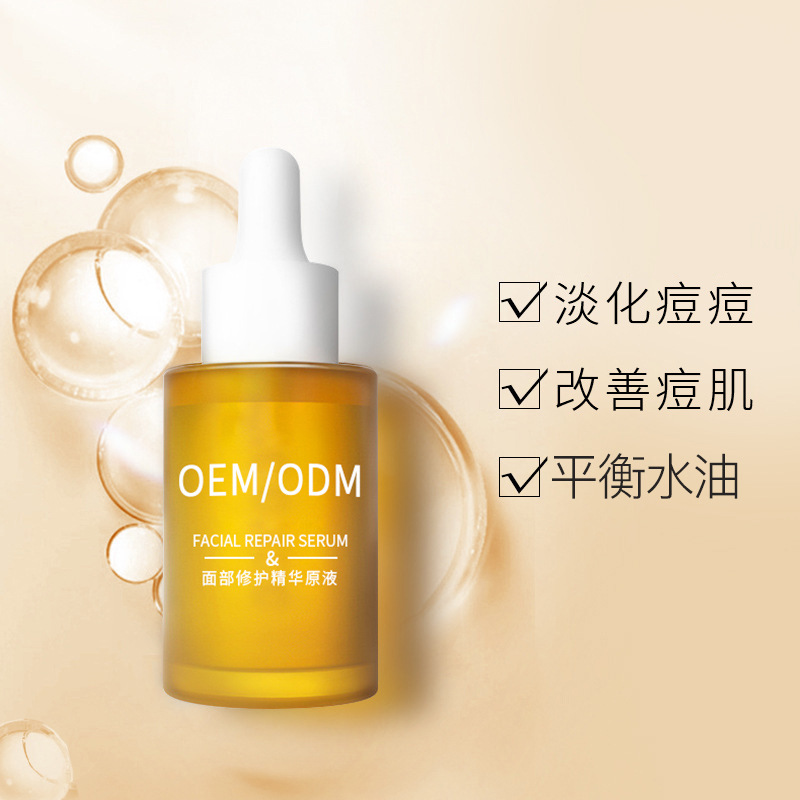 随州市_祛痘精华原液OEM